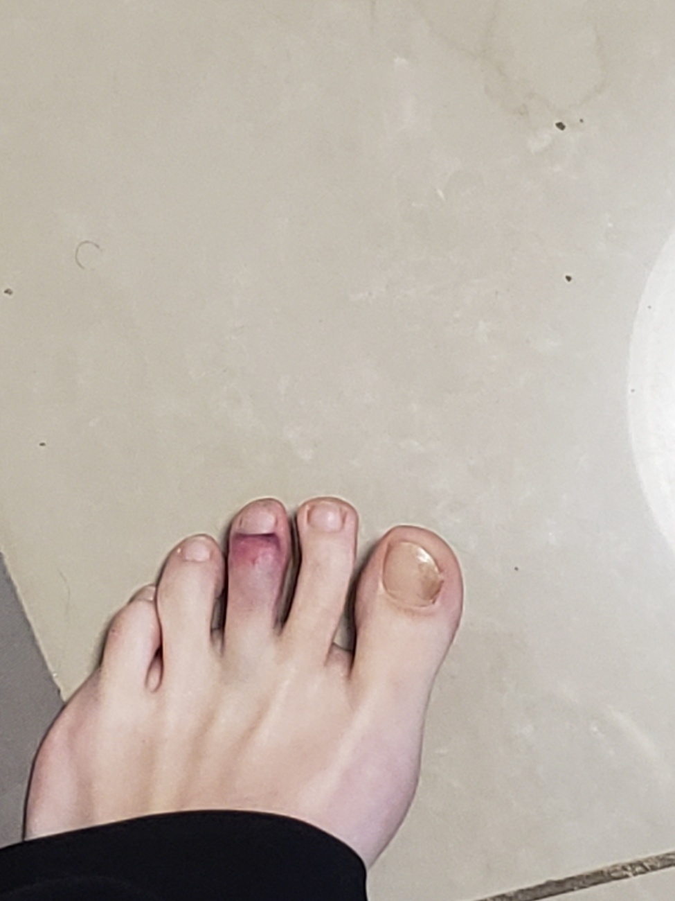 Foot